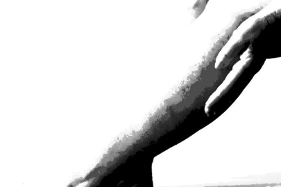 Sıcak havalar varis şikayetlerini de arttırıyor!